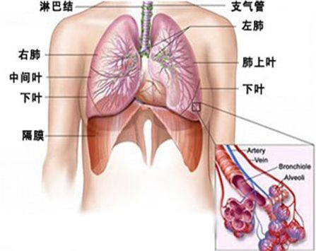 慢性支气管炎患者应该怎么护理
