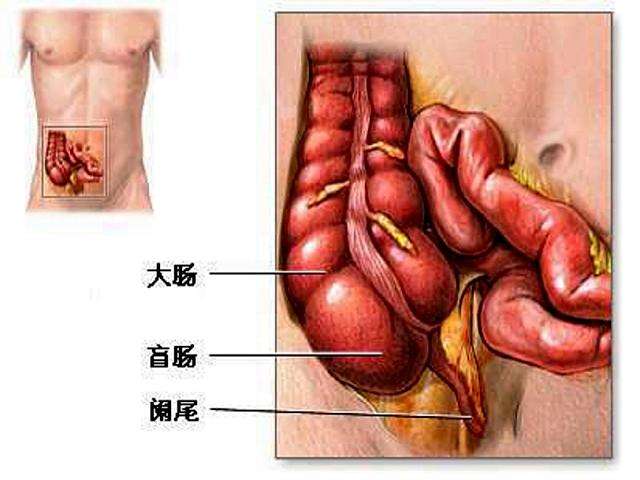 阑尾炎术后注意事项