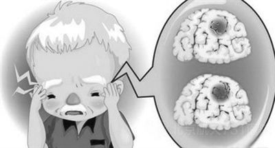 治疗中风的方法有哪些？