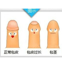 包皮动手术需要住院吗
