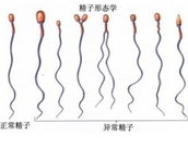 治疗不射精哪家医院好