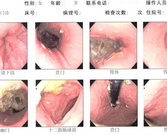 慢性胃炎患者注意事项