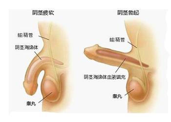 阳痿怎么治？